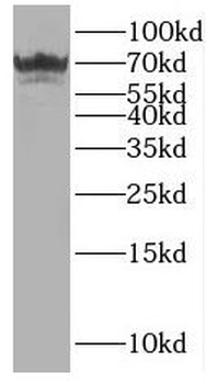 OAS2 Rabbit Polyclonal Antibody