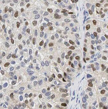 OAS2 Antibody