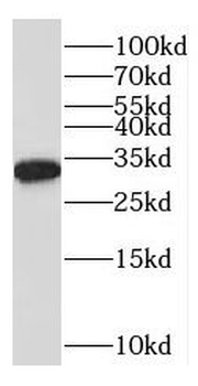 NABP2 Rabbit Polyclonal Antibody