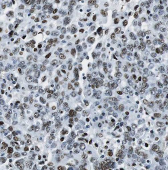NABP2 Rabbit Polyclonal Antibody
