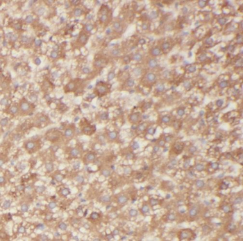 OCIAD1 Antibody