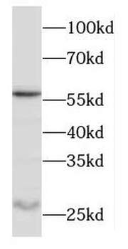 ODF1 Antibody
