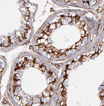 ODF1 Antibody