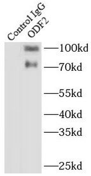 ODF2 Antibody