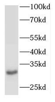CIMAP1A Rabbit Polyclonal Antibody