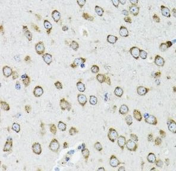 OGDH Antibody