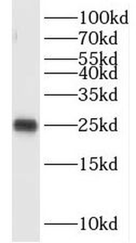 OIP5 Rabbit Polyclonal Antibody