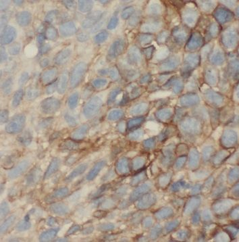 OLFM1 Antibody