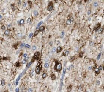 OPTN Antibody