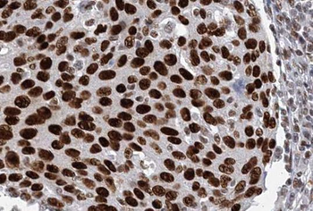 ORC6 Antibody
