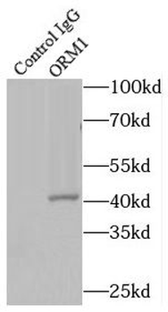 ORM1 Antibody