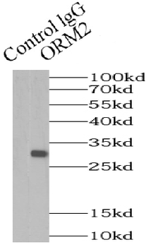 ORM2 Antibody