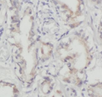 ORM2 Antibody