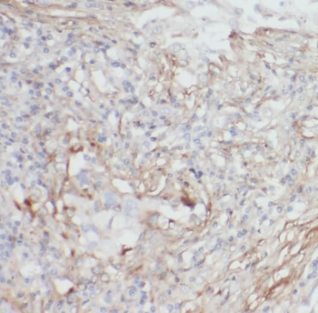 OS9 Antibody