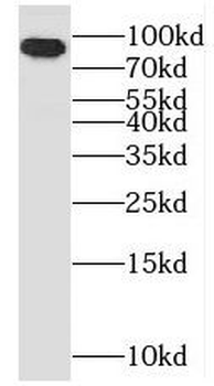 OSBP Antibody