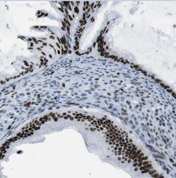 OSBP Antibody