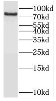 OSBPL10 Antibody