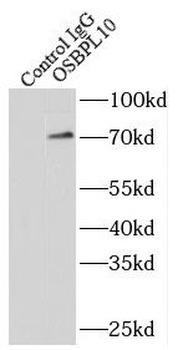 OSBPL10 Antibody