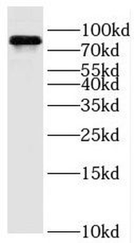 OSBPL11 Antibody