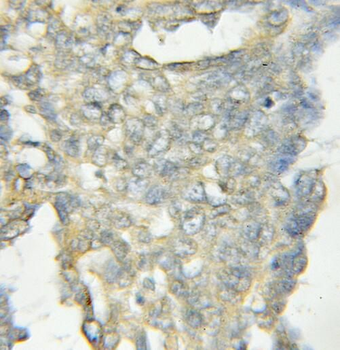 OSBPL11 Antibody