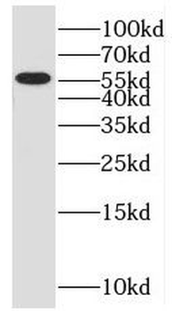 OSBPL2 Antibody