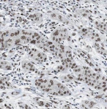 OSGEP Antibody