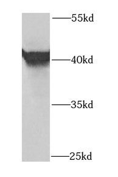 OSGEPL1 Antibody
