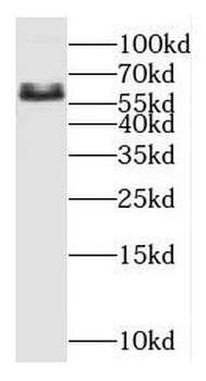 OSR1 Rabbit Polyclonal Antibody