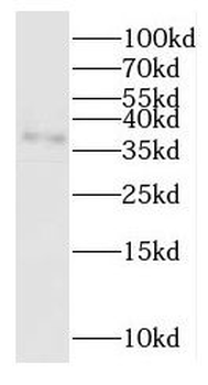 OGN Antibody