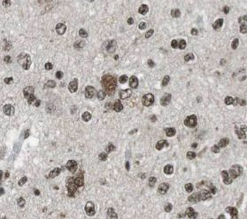 OTX2 Antibody