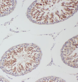 OXCT2 Antibody
