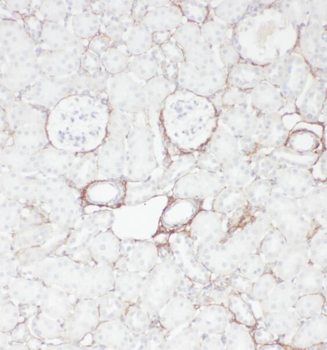 OXER1 Antibody