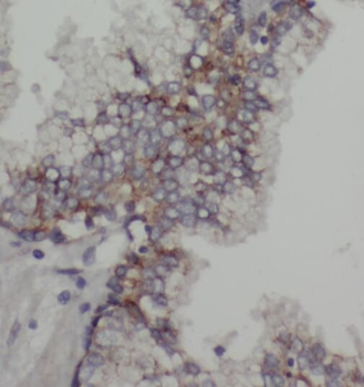 OXSR1 Antibody
