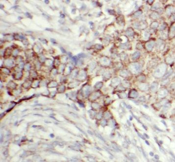 OXTR Antibody