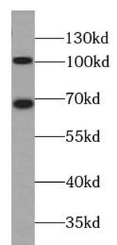 CTNND1 Antibody