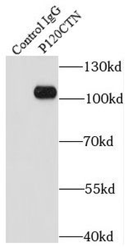 CTNND1 Antibody
