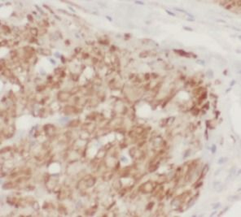 CTNND1 Antibody
