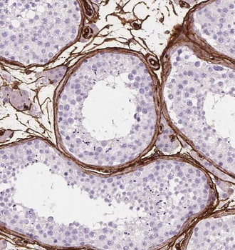 P2RY1 Antibody