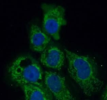 P4HA1 Antibody