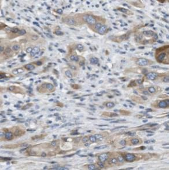 P4HA1 Antibody