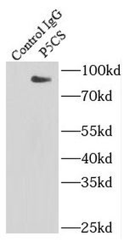 ALDH18A1 Antibody