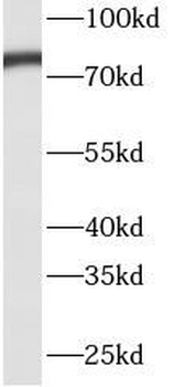 TP63 Rabbit Polyclonal Antibody