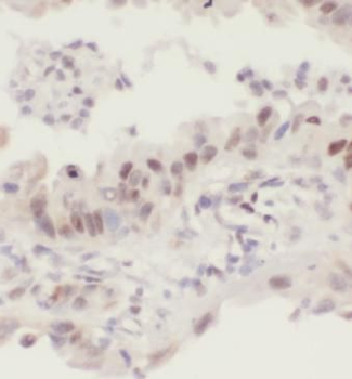 TP63 Rabbit Polyclonal Antibody