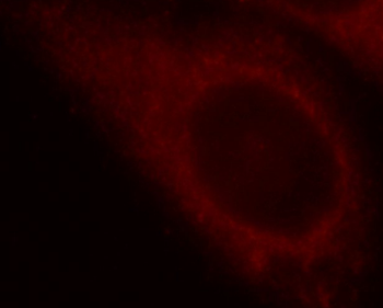 RELA Antibody
