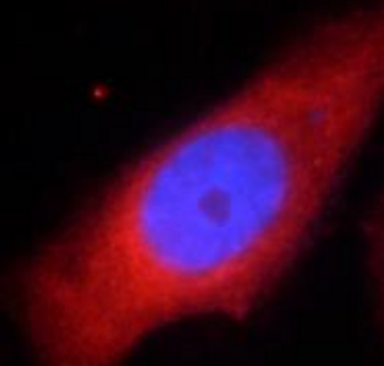RPS6KB1 Antibody