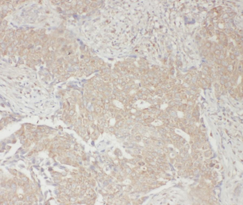 RPS6KB1 Antibody