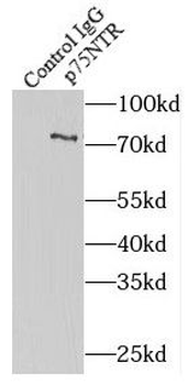 NGFR Antibody