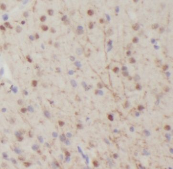 NGFR Antibody
