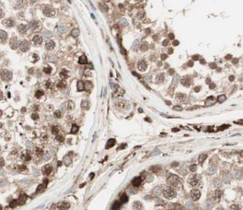 PABPC1 Antibody