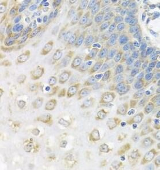 PABPC4 Antibody